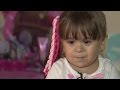 Niña se enfrenta a la vida con su extraña apariencia provocada por una rara enfermedad