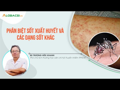 Sốt xuất huyết