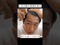 ミノキシジルの塗り方とコツとは？ #shorts
