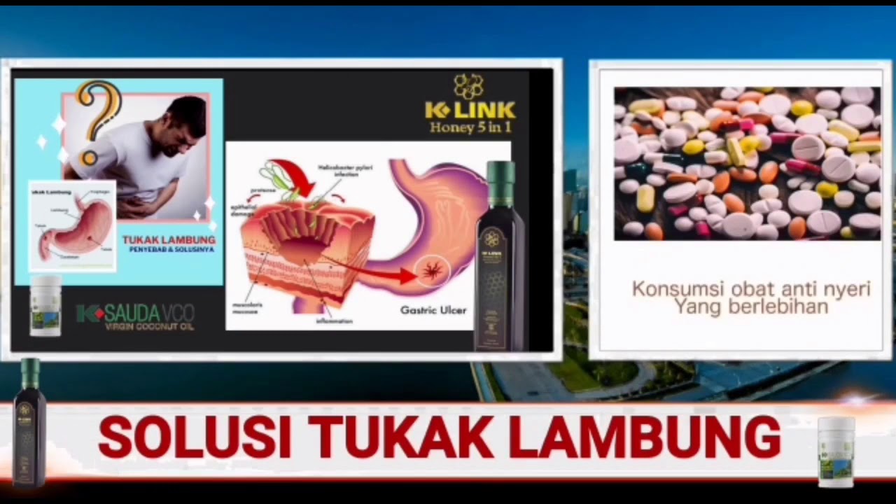 SOLUSI TUKAK LAMBUNG 