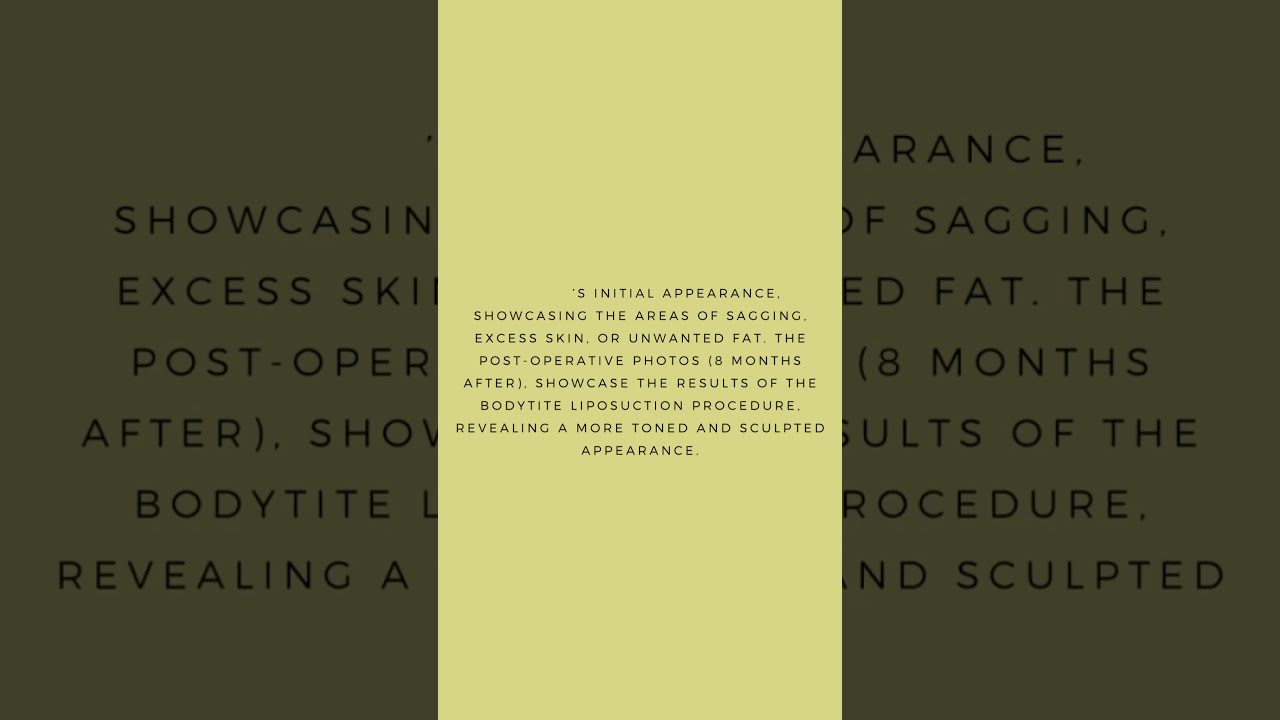 BODYTITE LIPOSUCTION – BEFORE AND AFTER PHOTOS | bodySCULPT | Plastic Surgery in Manhattan, NYC