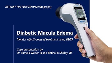 Diabetic Macular Edema: Tracking Patient Progress with ERG Technology, by Dr. Pamela Weber, MD.