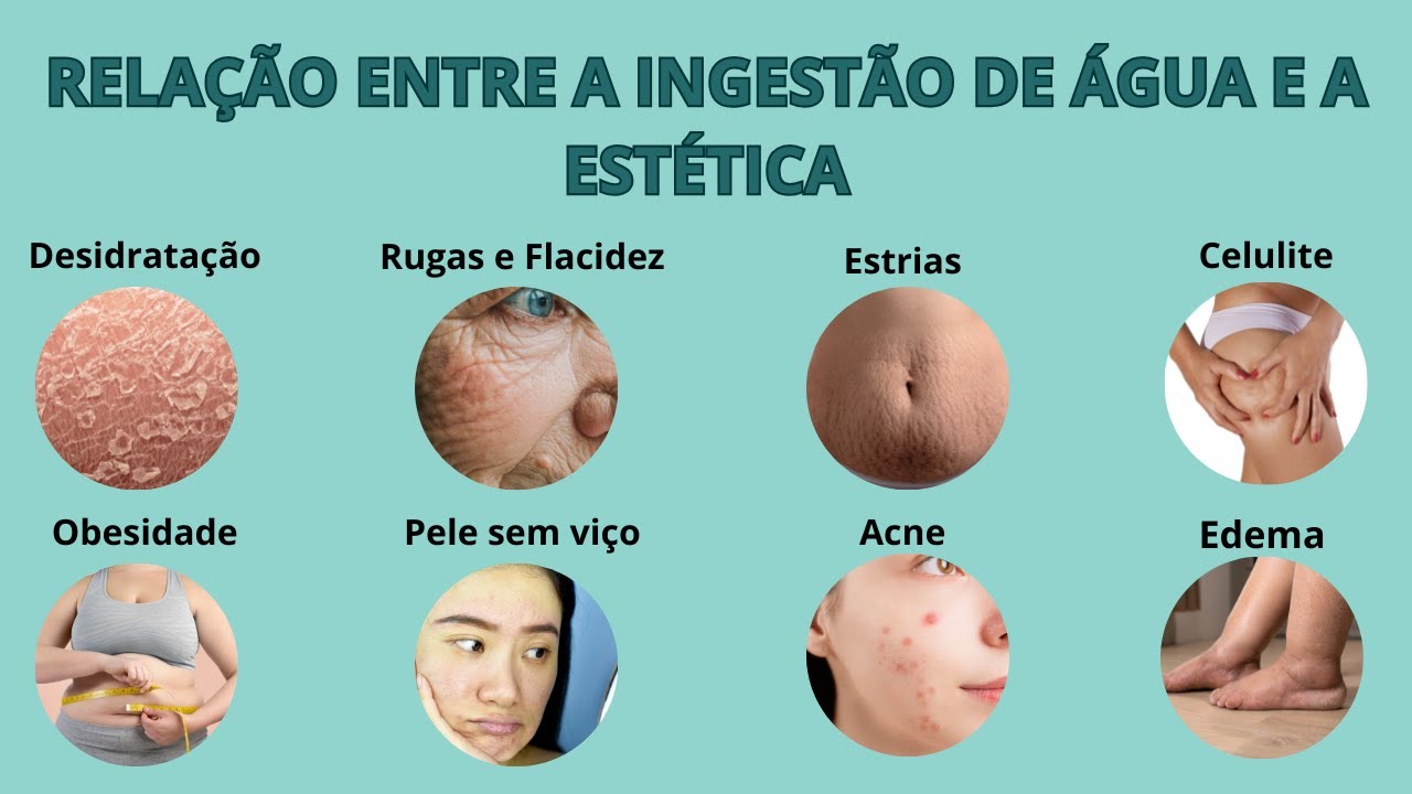 RELAÇÃO ENTRE A INGESTÃO DE ÁGUA E A ESTÉTICA