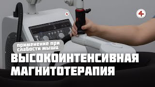 Применение высокоинтенсивной магнитотерапии в реабилитации и неврологии при слабости мышц