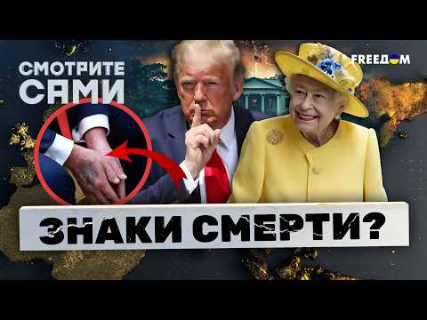 ЭТО НЕ ПРОСТО СИНЯКИ! Вот что НА САМОМ ДЕЛЕ случилось с Трампом! ВРАЧИ не смогли СКРЫТЬ ПРАВДУ!