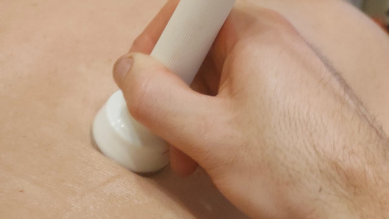 Ультразвуковой Фонофорез