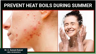 How to Prevent Heat Boils on Body | Summer Heat Boils on Face | Dr Suman | Socialpost Healthcare