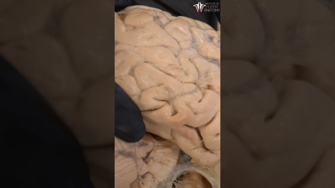 Your Brain is Hollow!