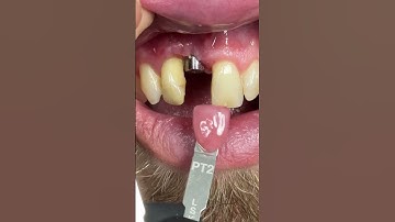 For tissue color matching tool!