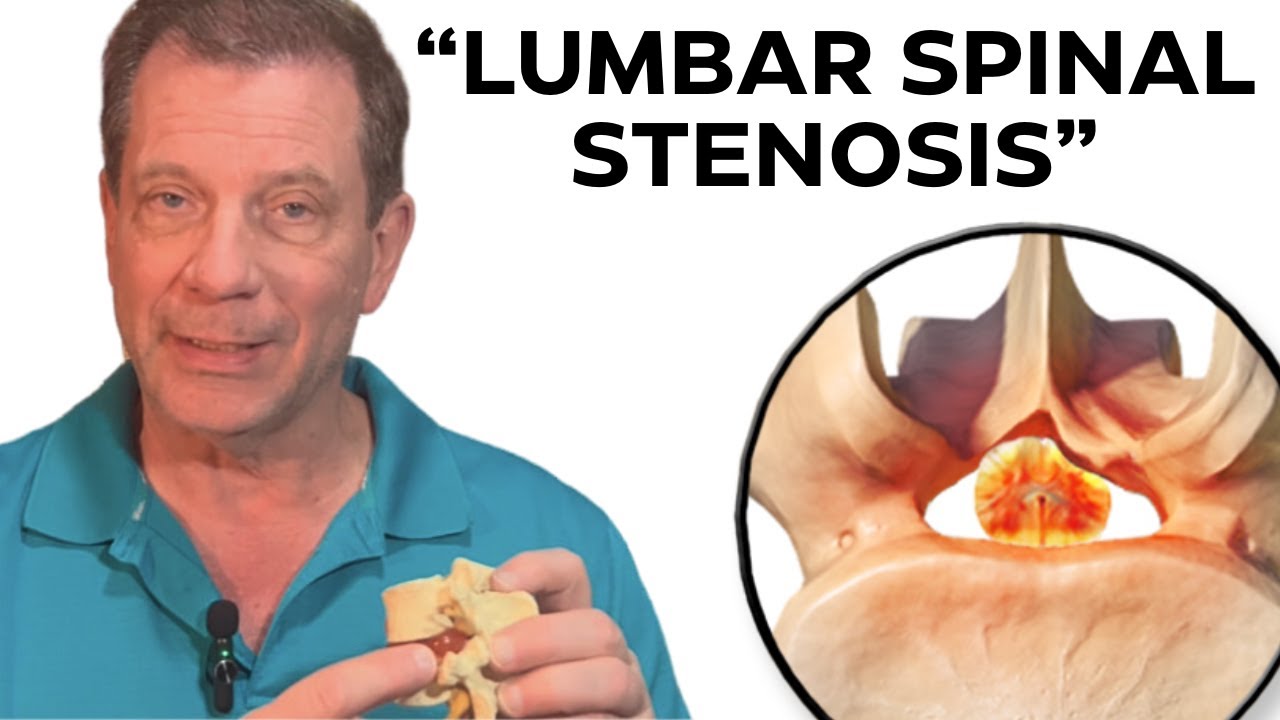 7 Step NonSurgical Treatment For Lumbar Spinal Stenosis Dr. John
