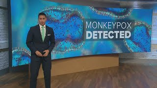 Monkeypox in Houston: Here's what you need to know