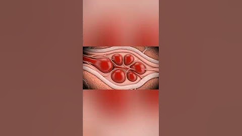 Erectile Tissue in 3D — How Erection Happens