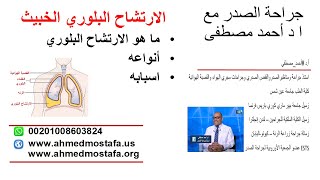 اد أحمد مصطفي أستاذ جراحة الصدر: الارتشاح البلوري | الغشاء البلوري | التجمع المائي حول الرئة