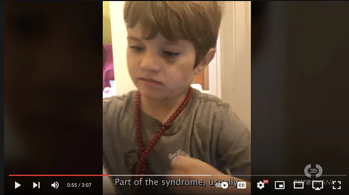 Asa: A Story about Self Harm (Phelan-McDermid syndrome)