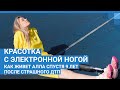 Красотка с электронной ногой. Как живет Алла спустя 9 лет после страшного ДТП| NGS.RU