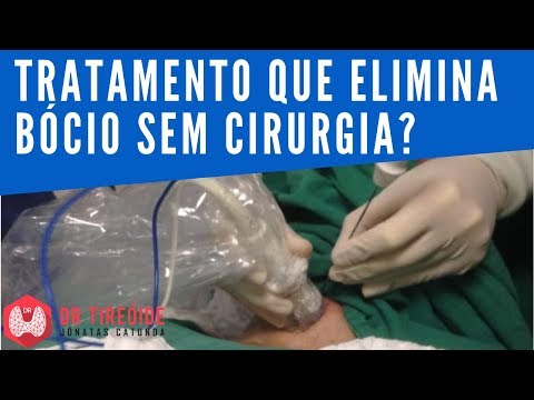 Vídeo: Tratamento De Bócio Da Glândula Tireóide Com Remédios Populares: Receitas Eficazes