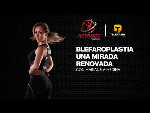 Blefaroplastia: una mirada renovada