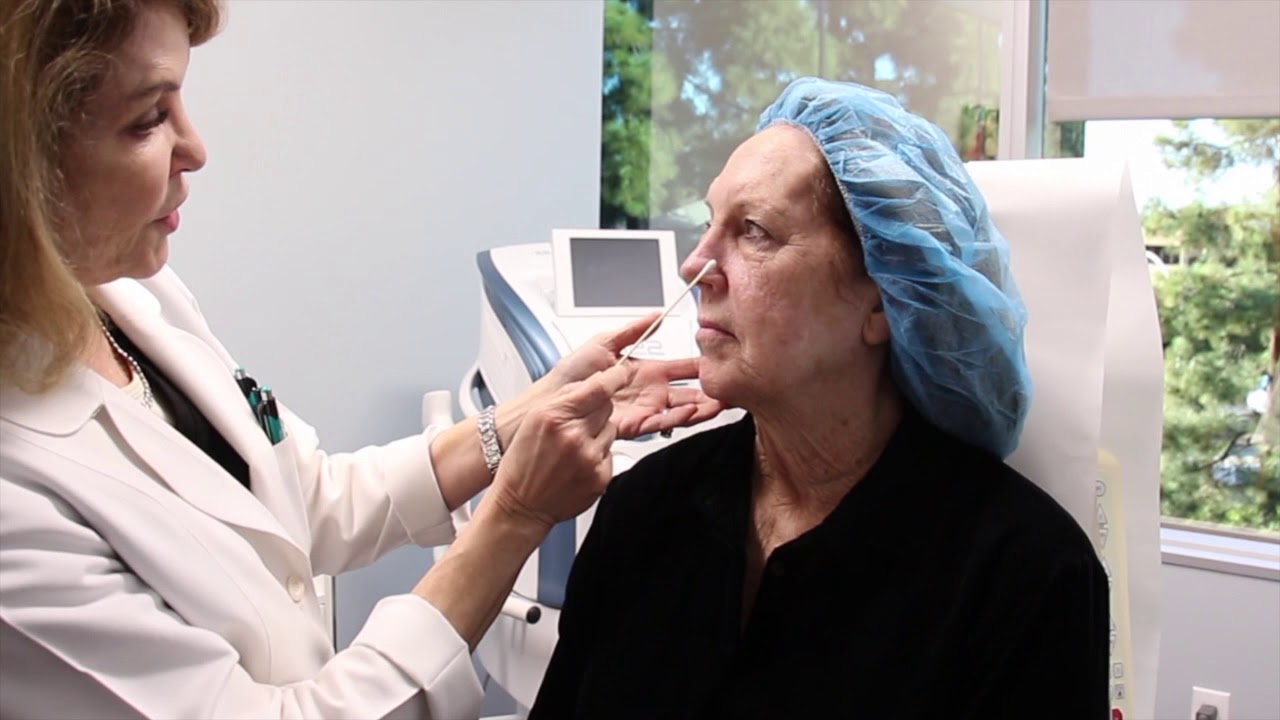 IPL Photofacial Treatment on a Skin Cancer YouTube