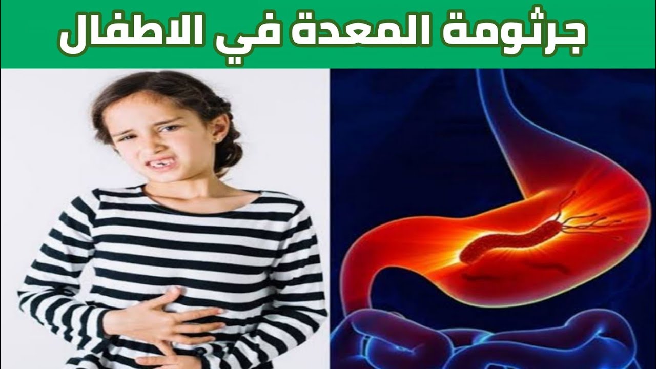 جرثومة المعدة | مرض خطير يهدد صحة طفلك |طرق العدوى ، اسبابها و طريقة علاجها و التخلص منها نهائيا
