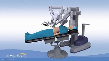 da Vinci Single-Site Cholecystectomy (Gallbladder Surgery)