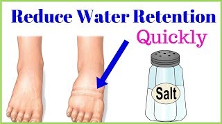 6 Tips to reduce water retention problem