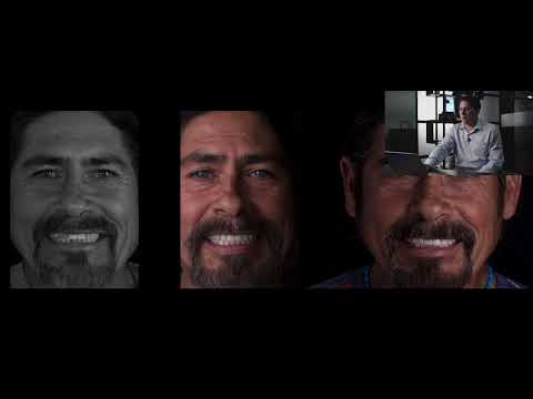 Oscar Vizcarra - Impresiones 3D para coronas de disilicato de litio.