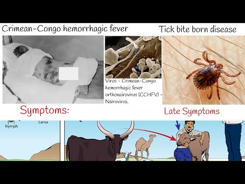 Crimean-Congo hemorrhagic fever - Symptoms and treatment. Who is at risk?