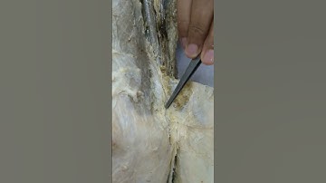 SARTORIUS MUSCLE