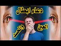 دعاء ابطال العين والحسد لكل عين قوية وكل عين قديمة متراكمة فى الجسد أقوي رقية شرعية للعين والحسد دعاء ابطال العين والحسد لكل عين قوية وكل عين قديمة متراكمة فى الجسد أقوي رقية شرعية للعين والحسد