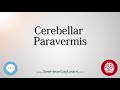 Cerebellar paravermis   anatomy of the brain   seehearsaylearn 