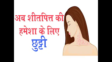 अब शीतपित्त की हमेशा के लिए छुट्टी II Urticaria Treatment || Dr. Parmeshwar Arora