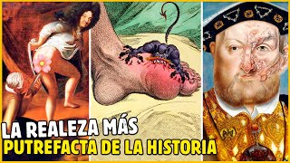 DEL &quot;BOTÓN&quot; DE LUIS XIV HASTA LA GOTA DE ENRIQUE VIII, LA REALEZA MÁS PUTREFACTA DE LA HISTORIA