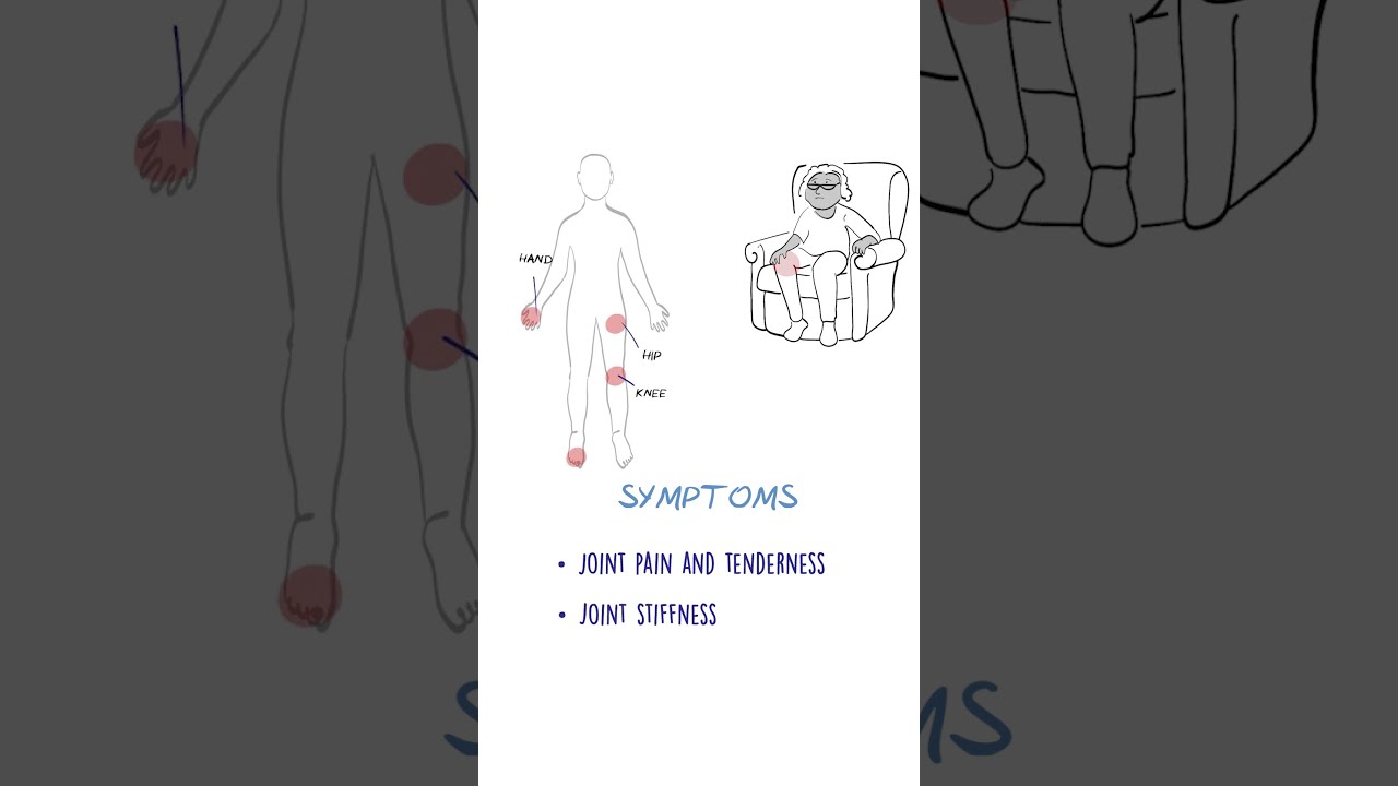 Osteoarthritis EXPLAINED Jointpain Arthritis Healthsketch