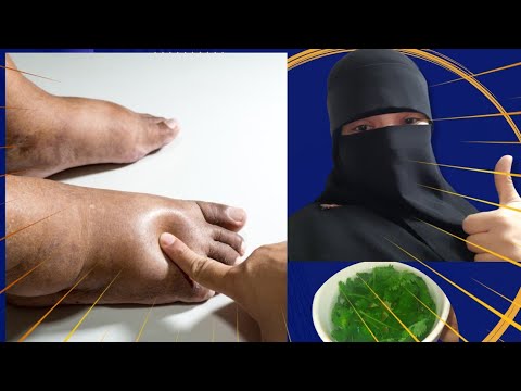 مشروب يخلص الجسم من احتباس السوائل في الجسم