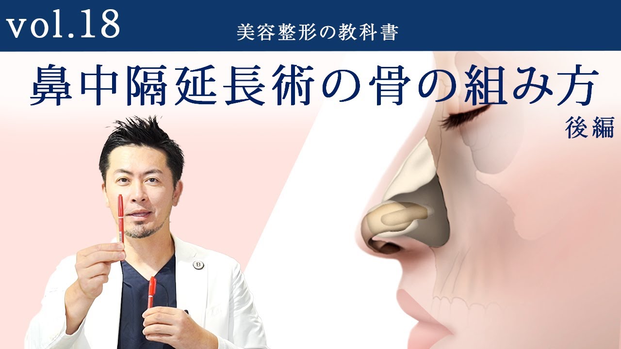 vol.18 【完全版】鼻中隔延長術の骨の組み方［後編］後戻りと