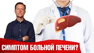 Первый симптом жирной печени✔️