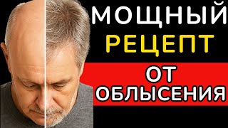 видео: НАНЕСИ ЭТО на голову — выпадение прекратится, а ВОЛОСЫ СТАНУТ ГУСТЫМИ НАВСЕГДА ! картинка: НАНЕСИ ЭТО на голову — выпадение прекратится, а ВОЛОСЫ СТАНУТ ГУСТЫМИ НАВСЕГДА !