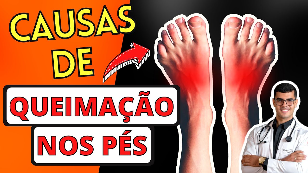 9 Causas de QUEIMAÇÃO NOS PÉS (FORMIGAMENTO e DOR nos Pés) - YouTube