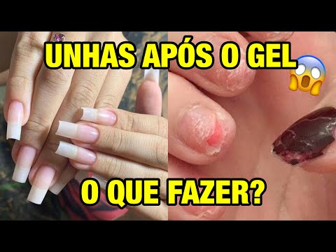 Vídeo: Como reparar as unhas após uma manicure com gel: 12 etapas (com fotos)