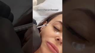 Как работает ботокс ботулотоксин Эффект,результат📍Краснодар #косметология #ботокс #ботокскраснодар