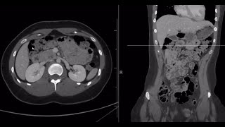 Select abdominal CT anatomy