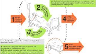Your WHO 5 moments for Hand Hygiene along the patient journey in surgery