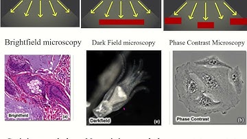 Principles of bright field, dark field & phase contrast microscopy #microscope