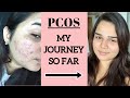 How I found out I have PCOS/PCOD and My Progress so far..