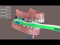 Dişlərin düzgün fırçalanması.