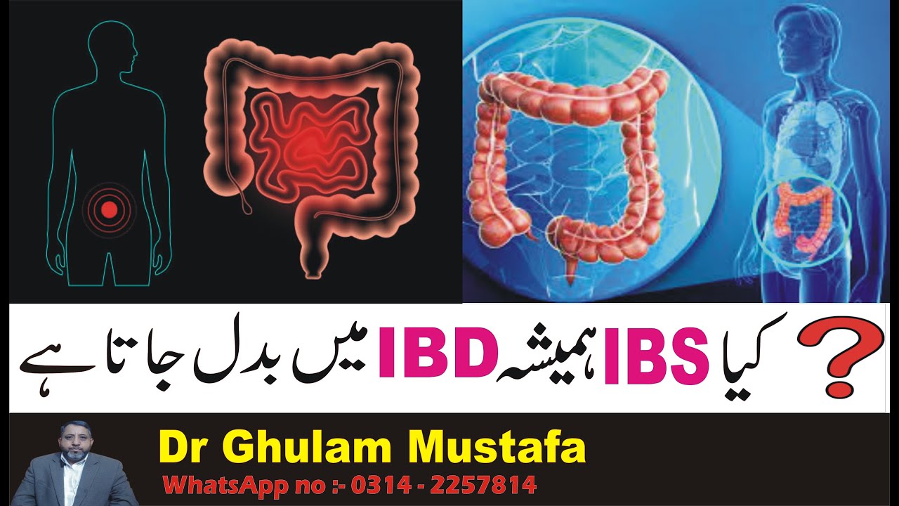 Does IBS Always Turn Into IBD YouTube does-ibs-always-turn-into-ibd-youtube
