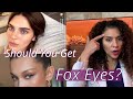 Should You Get the Fox Eyes Lift? *Trendy* Thread Lift  explained by Doctor
