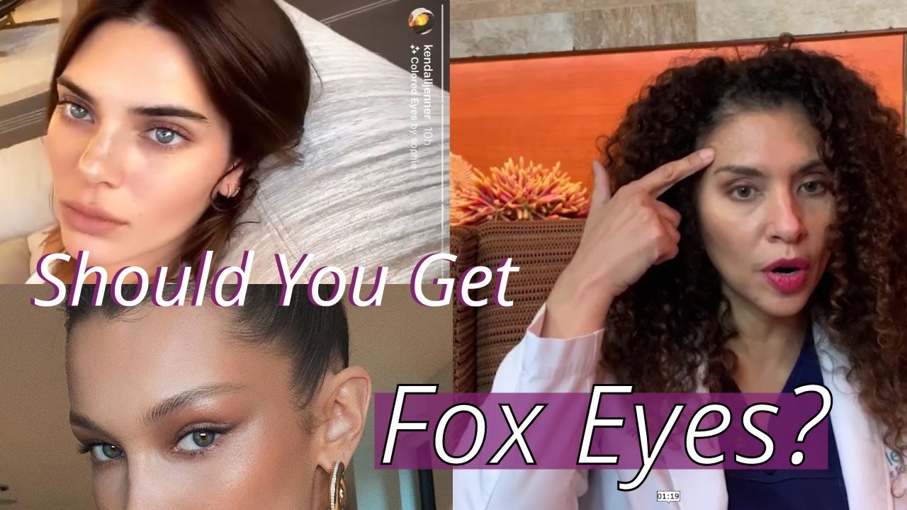 Should You Get the Fox Eyes Lift? *Trendy* Thread Lift  explained by Doctor