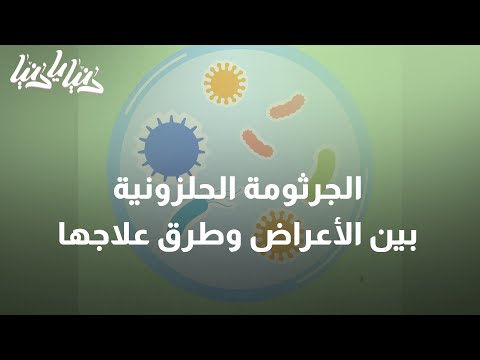 تعرفوا على أعراض الجرثومة الحلزونية دنيا يا دنيا الجرثومة الحلزونية