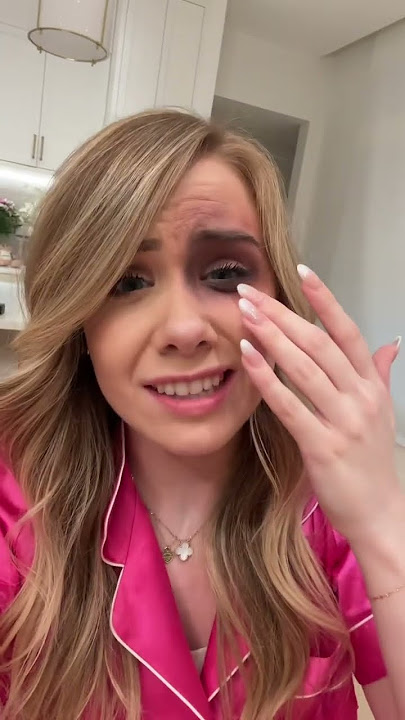 MY BEST FRIEND PUNCHED ME IN THE FACE...